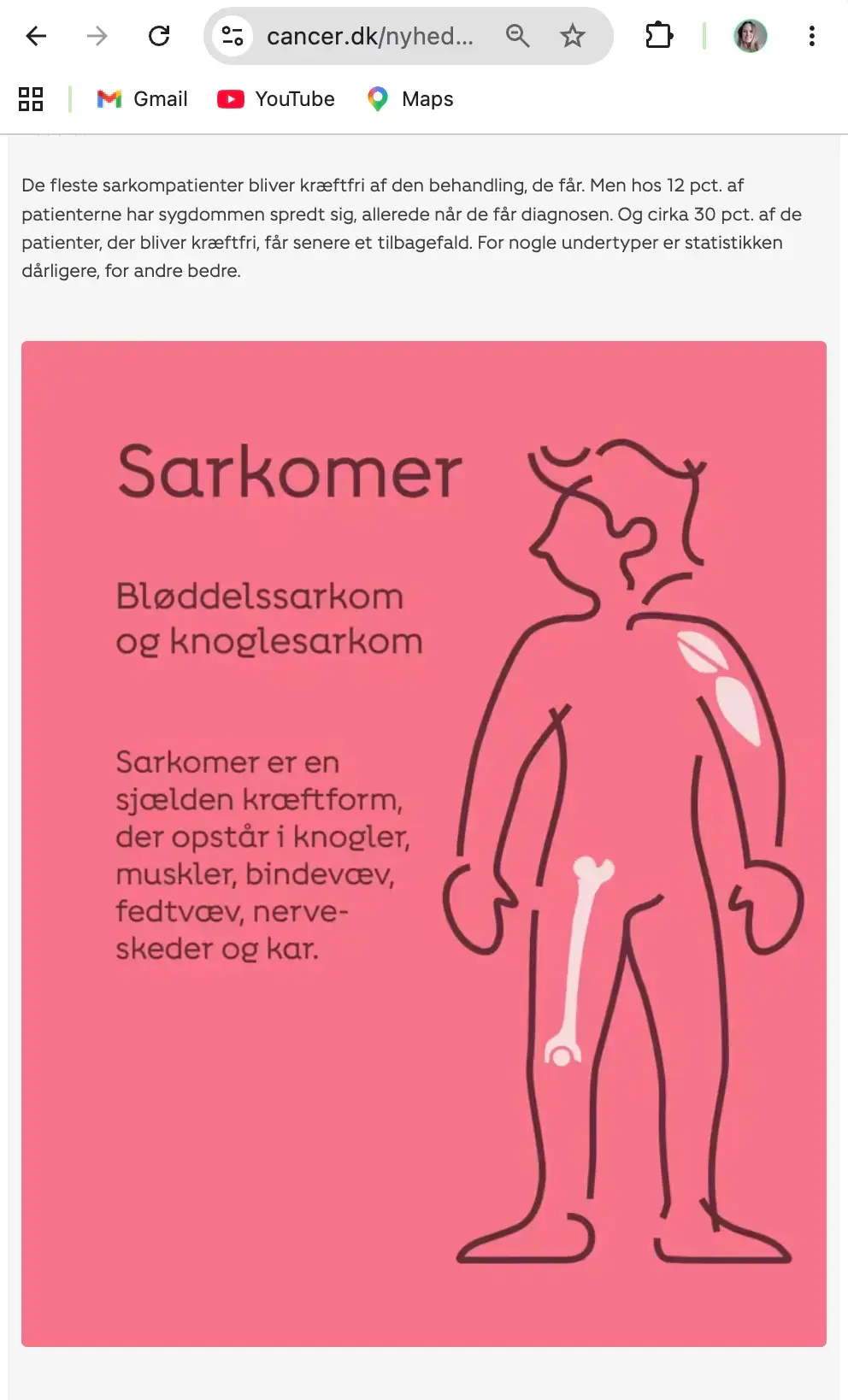 sarkom